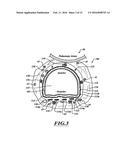 SYSTEMS, DEVICES, AND METHODS FOR TREATING A PULMONARY DISORDER WITH AN     AGENT diagram and image