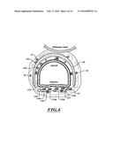 SYSTEMS, DEVICES, AND METHODS FOR TREATING A PULMONARY DISORDER WITH AN     AGENT diagram and image