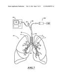 SYSTEMS, DEVICES, AND METHODS FOR TREATING A PULMONARY DISORDER WITH AN     AGENT diagram and image