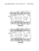 SYSTEMS, DEVICES, AND METHODS FOR TREATING A PULMONARY DISORDER WITH AN     AGENT diagram and image