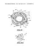 SYSTEMS, DEVICES, AND METHODS FOR TREATING A PULMONARY DISORDER WITH AN     AGENT diagram and image