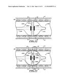 SYSTEMS, DEVICES, AND METHODS FOR TREATING A PULMONARY DISORDER WITH AN     AGENT diagram and image