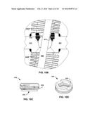 MECHANICAL FEEDTHROUGHS FOR IMPLANTABLE MEDICAL DEVICE diagram and image