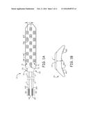 NOVEL FEATURES FOR ROUTING CONDUCTORS IN MEDICAL ELECTRICAL LEAD ELECTRODE     ASSEMBLIES diagram and image