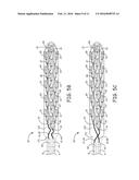 NOVEL FEATURES FOR ROUTING CONDUCTORS IN MEDICAL ELECTRICAL LEAD ELECTRODE     ASSEMBLIES diagram and image