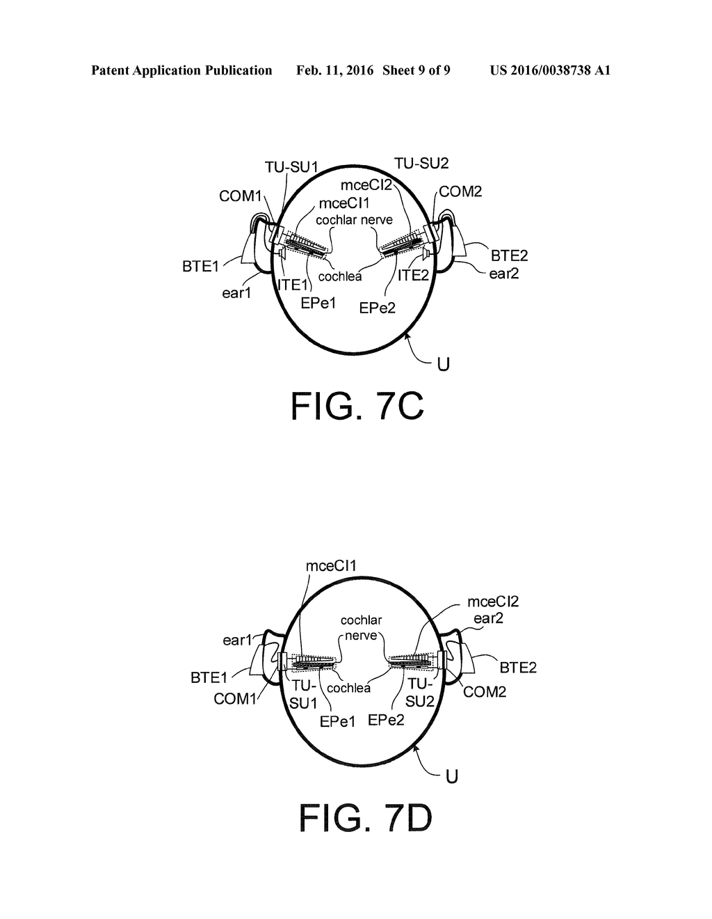 HEARING ASSISTANCE SYSTEM WITH IMPROVED SIGNAL PROCESSING COMPRISING AN     IMPLANTED PART - diagram, schematic, and image 10