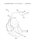 IMPLANTABLE MEDICAL DEVICE COATING FOR WETTING AND MICROBIAL RESISTANCE diagram and image