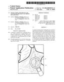 NEURAL STIMULATION DEVICES AND SYSTEMS FOR TREATMENT OF CHRONIC     INFLAMMATION diagram and image