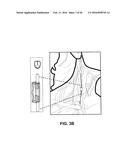 NEURAL STIMULATION DEVICES AND SYSTEMS FOR TREATMENT OF CHRONIC     INFLAMMATION diagram and image