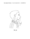 NEURAL STIMULATION DEVICES AND SYSTEMS FOR TREATMENT OF CHRONIC     INFLAMMATION diagram and image