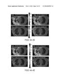 SYSTEMS AND METHODS FOR RADIATION TREATMENT PLANNING USING COMBINED     IMAGING AND TREATMENT DOSE diagram and image