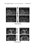 SYSTEMS AND METHODS FOR RADIATION TREATMENT PLANNING USING COMBINED     IMAGING AND TREATMENT DOSE diagram and image