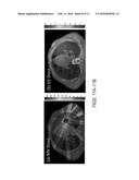 SYSTEMS AND METHODS FOR RADIATION TREATMENT PLANNING USING COMBINED     IMAGING AND TREATMENT DOSE diagram and image