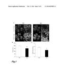 INTRAOCULAR ANGIOGENESIS INHIBITOR AND USES THEREOF diagram and image