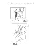 COATING COMPOSITION AND METHOD diagram and image