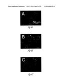 siRNA-MEDIATED GENE SILENCING diagram and image