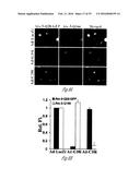 siRNA-MEDIATED GENE SILENCING diagram and image