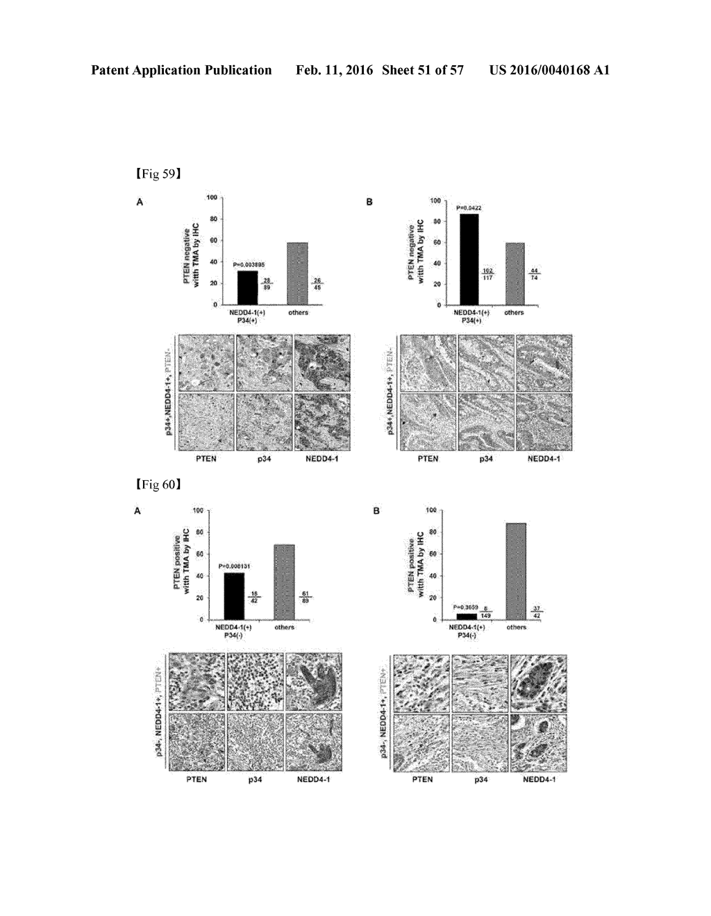 Composition for Treatment or Metastasis Suppression of Cancers Which     Includes P34 Expression Inhibitor or Activity Inhibitor as Active     Ingredient - diagram, schematic, and image 52