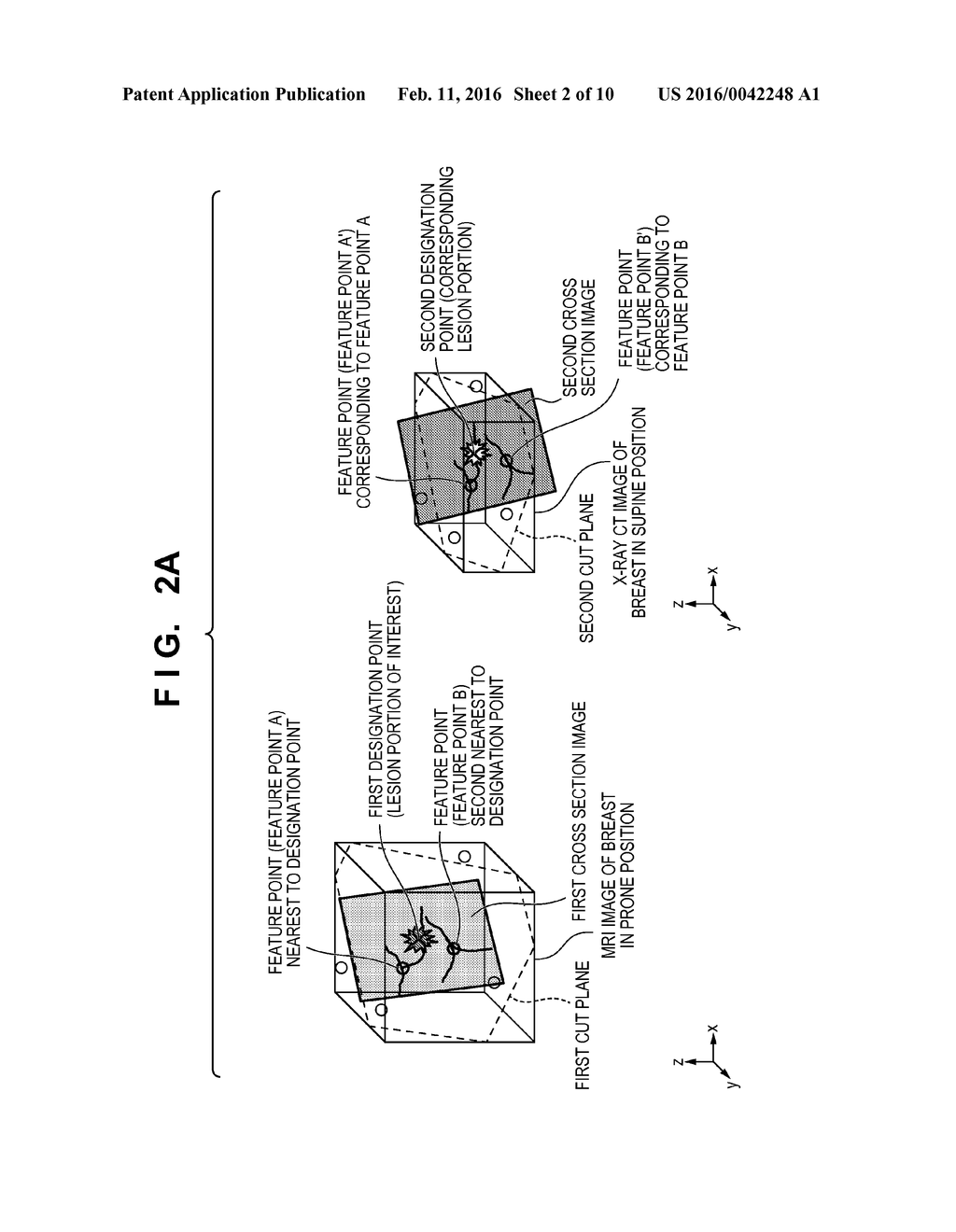 IMAGE PROCESSING APPARATUS, IMAGE PROCESSING METHOD, MEDICAL IMAGE     DIAGNOSTIC SYSTEM, AND STORAGE MEDIUM - diagram, schematic, and image 03