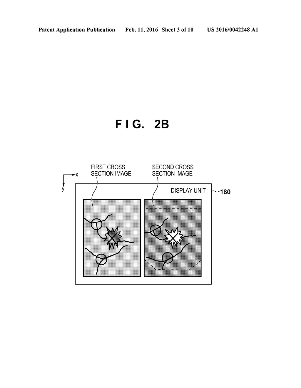 IMAGE PROCESSING APPARATUS, IMAGE PROCESSING METHOD, MEDICAL IMAGE     DIAGNOSTIC SYSTEM, AND STORAGE MEDIUM - diagram, schematic, and image 04