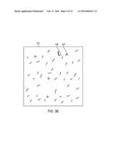 Methods and Systems for Hair Transplantation Using Time Constrained Image     Processing diagram and image