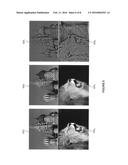 Surface normal estimation for use in rendering an image diagram and image