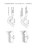 SHIELDED ELECTRICAL CONTACT AND DOPING THROUGH A PASSIVATING DIELECTRIC     LAYER IN A HIGH-EFFICIENCY CRYSTALLINE SOLAR CELL, INCLUDING STRUCTURE     AND METHODS OF MANUFACTURE diagram and image