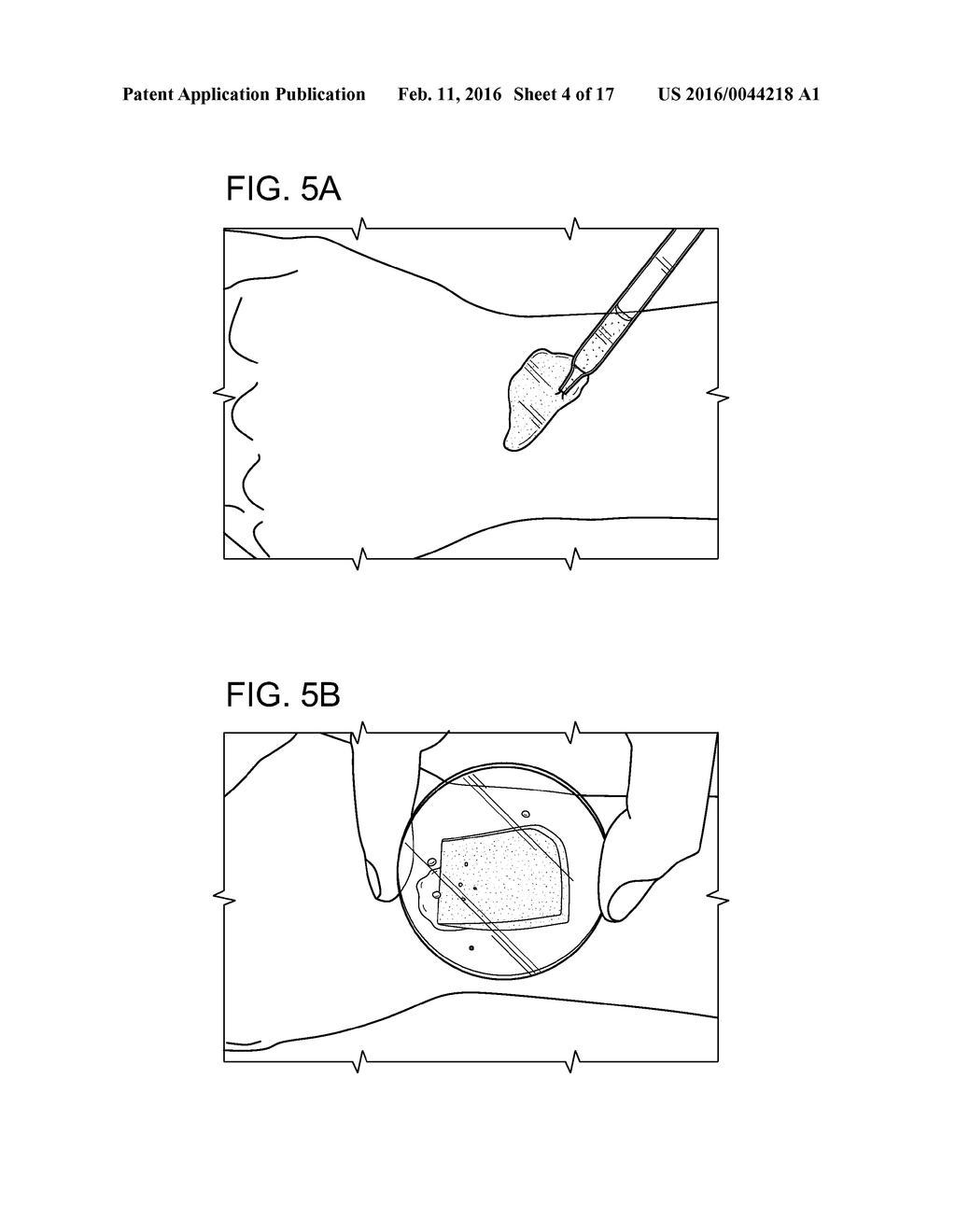 HIGH-RESOLUTION SURFACE MEASUREMENT SYSTEMS AND METHODS - diagram, schematic, and image 05