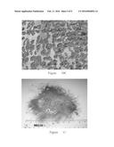 LIGHTNING STRIKE AND ELECTROMAGNETIC PROTECTION SYSTEM diagram and image