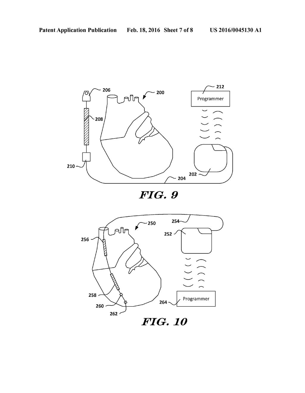 METHODS AND IMPLANTABLE DEVICES FOR DETECTING ARRHYTHMIA - diagram, schematic, and image 08