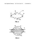 BLOOD FLOW DISRUPTION DEVICES AND METHODS FOR THE TREATMENT OF VASCULAR     DEFECTS diagram and image