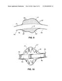 BLOOD FLOW DISRUPTION DEVICES AND METHODS FOR THE TREATMENT OF VASCULAR     DEFECTS diagram and image