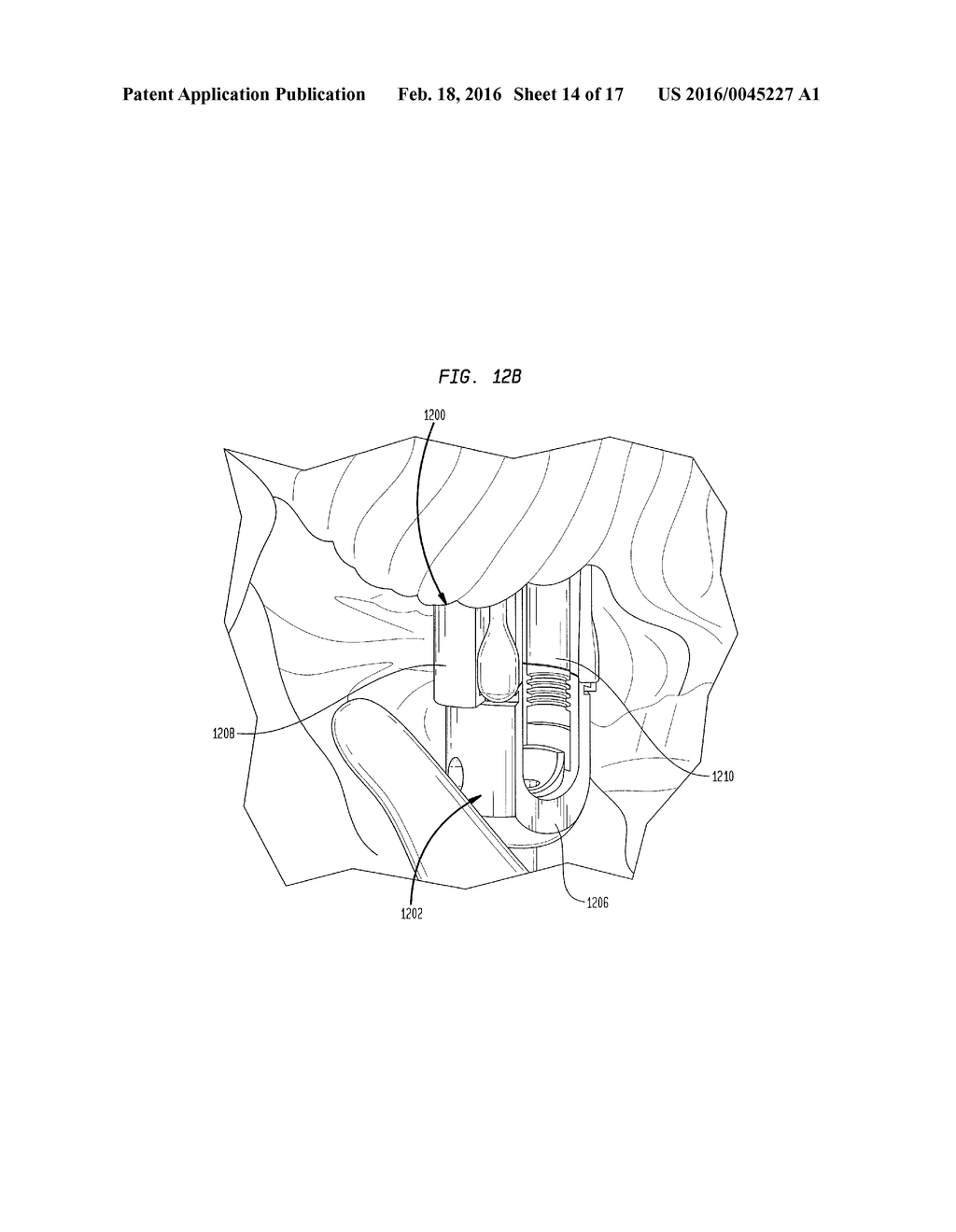 DEVICES AND METHODS FOR MONOAXIAL SCREW CONVERSION - diagram, schematic, and image 15