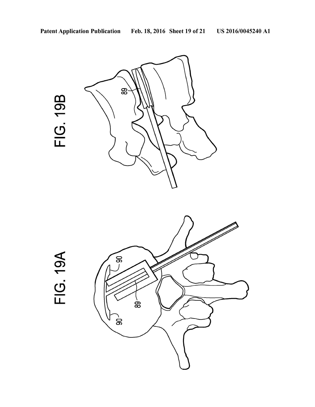 Balloon With Shape Control For Spinal Procedures - diagram, schematic, and image 20