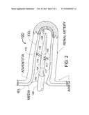 METHOD FOR SELECTION AND TREATMENT OF HYPERTENSIVE PATIENTS WITH RENAL     DENERVATION diagram and image