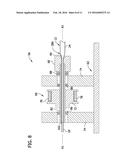 MATERIAL REMOVAL FROM BALLOON CONE diagram and image