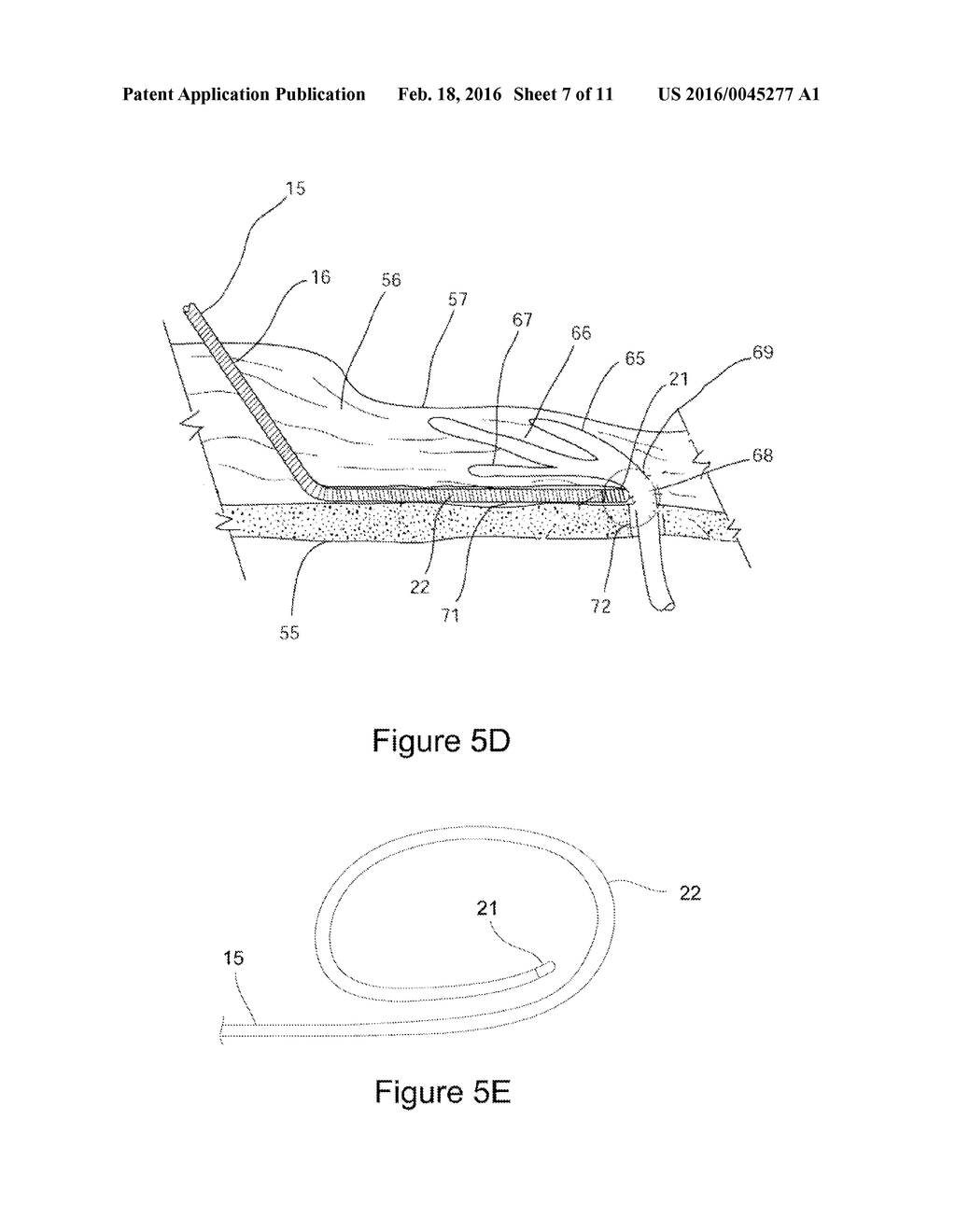 APPARATUS AND METHOD FOR TREATING RHINITIS - diagram, schematic, and image 08