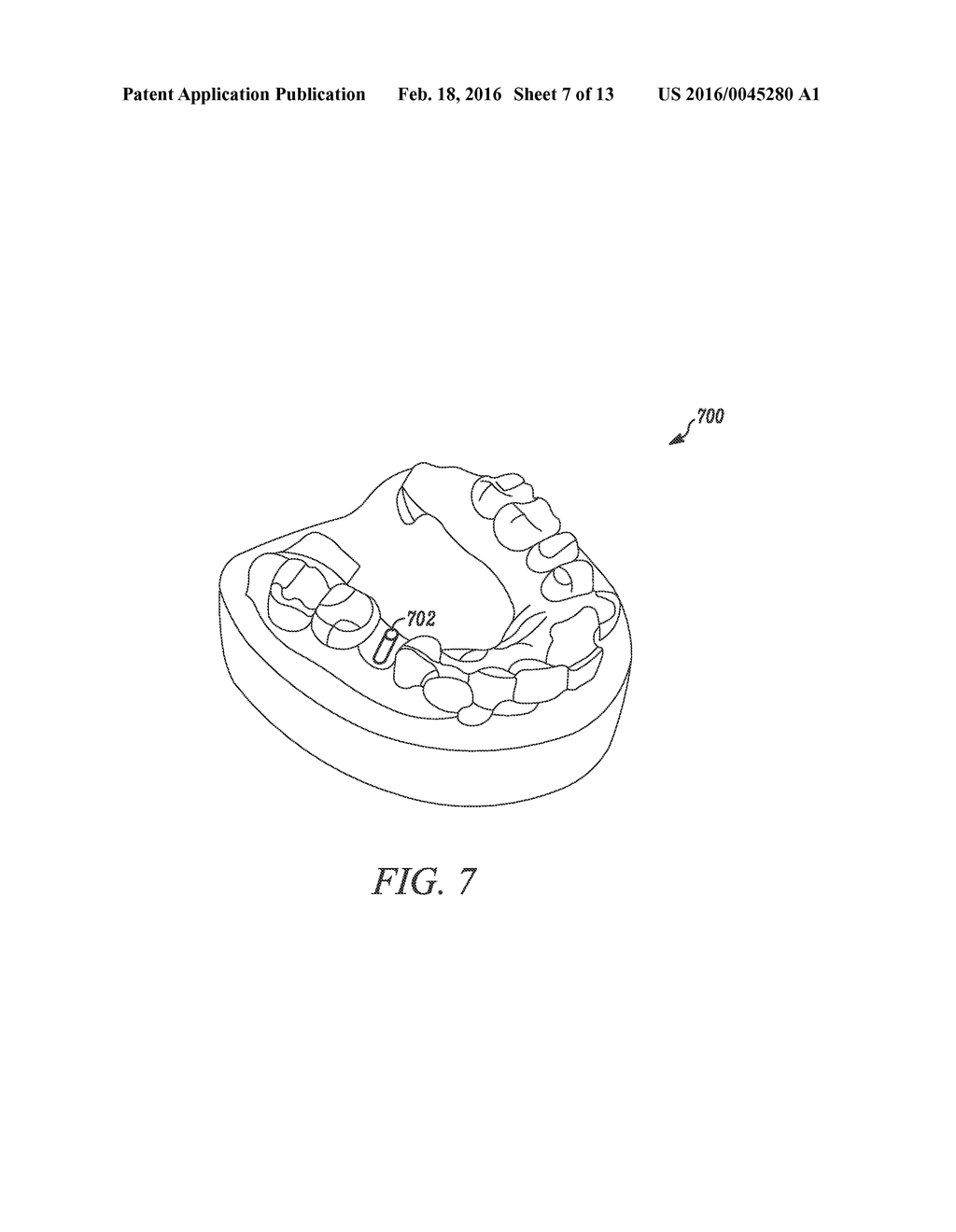 MULTI-LAYER SURGICAL GUIDE - diagram, schematic, and image 08