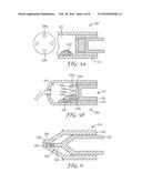 A PLUNGER ASSEMBLY AND A CAPSULE FOR DISPENSING A DENTAL MATERIAL diagram and image