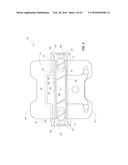 Orthodontic Bracket diagram and image