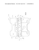 Orthodontic Bracket diagram and image