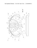 Orthodontic Bracket diagram and image