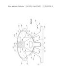 Orthodontic Bracket diagram and image