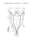 VEIN FILTER diagram and image