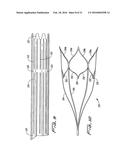 VEIN FILTER diagram and image