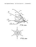 VEIN FILTER diagram and image