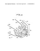 VEIN FILTER diagram and image