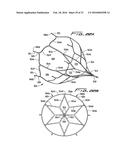 VEIN FILTER diagram and image