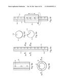 METHOD AND APPARATUS FOR TREATING URETHRAL STRICTURE diagram and image