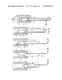 METHOD AND APPARATUS FOR TREATING URETHRAL STRICTURE diagram and image